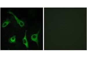 Immunofluorescence analysis of COS7 cells, using EDG1 Antibody. (S1PR1 Antikörper  (AA 5-54))