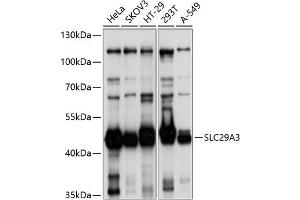 Western blot analysis of extracts of various cell lines, using SLC29 antibody (ABIN6132901, ABIN6147951, ABIN6147952 and ABIN6214611) at 1:1000 dilution. (SLC29A3 Antikörper  (AA 1-110))