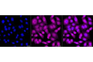 Immunocytochemical staining of HepG2 cells with Protein phosphatase 1 catalytic subunit beta antibody (ABIN7800017), 1:1,000).