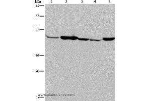 Western blot analysis of Human fetal muscle tissue, Jurkat and 293T cell, Hela cell and mouse liver tissue, using IDH2 Polyclonal Antibody at dilution of 1:600 (IDH2 Antikörper)
