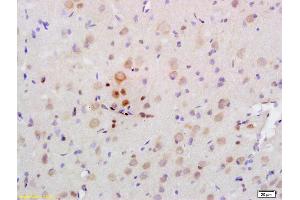 Formalin-fixed and paraffin embedded rat brain labeled with Rabbit Anti PRKAA2/AMPK alpha 2 Polyclonal Antibody, Unconjugated (ABIN680458) at 1:200 followed by conjugation to the secondary antibody and DAB staining (PRKAA2 Antikörper  (AA 351-450))
