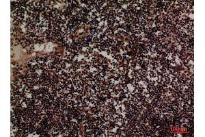 Immunohistochemistry (IHC) analysis of paraffin-embedded Human Lymph, antibody was diluted at 1:100.