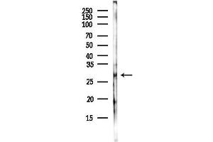 Western blot analysis of lysates from COLO205 cells(heat-shock,45 min treatment), using H1FNT Antibody at 1/1000 dilution.