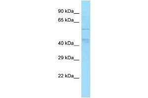 WB Suggested Anti-TBC1D22A Antibody Titration: 1. (TBC1D22A Antikörper  (Middle Region))