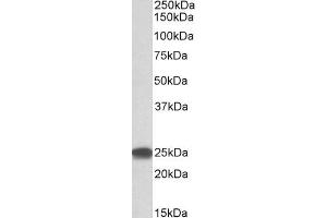 Western Blotting (WB) image for anti-Proteasome (Prosome, Macropain) Subunit, beta Type, 4 (PSMB4) (Internal Region) antibody (ABIN5539640)