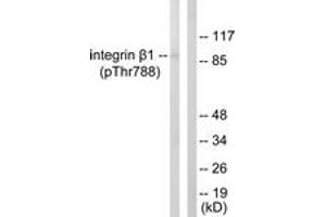 Western blot analysis of extracts from HeLa cells treated with UV 15', using Integrin beta1 (Phospho-Thr788) Antibody. (ITGB1 Antikörper  (pThr788))