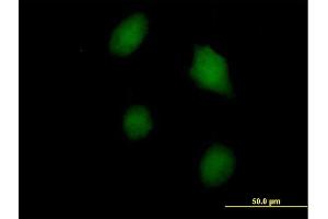 Immunofluorescence of purified MaxPab antibody to LGALS3 on HeLa cell.