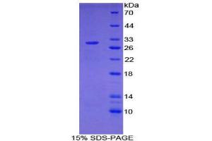 SDS-PAGE (SDS) image for Nucleoporin 107kDa (NUP107) (AA 554-784) protein (His tag) (ABIN1879625)