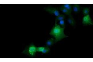 Image no. 6 for anti-ERG, ETS transcription factor (ERG) antibody (ABIN1498079) (ERG Antikörper)