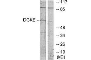 Western blot analysis of extracts from K562 cells, using DGKE Antibody. (DGKE Antikörper  (AA 161-210))
