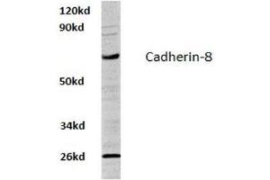 Image no. 1 for anti-Cadherin 8 (CDH8) antibody (ABIN317620) (Cadherin 8 Antikörper)