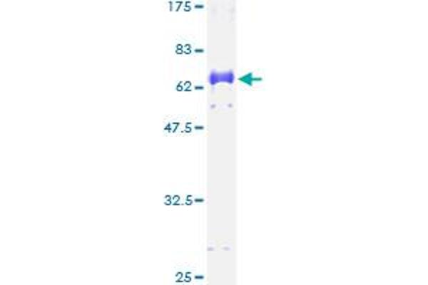 DLX3 Protein (AA 1-287) (GST tag)