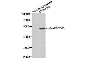 Western blot analysis of extracts from mouse brain tissue, using phospho-MAPT-T205 antibody (ABIN2987497). (MAPT Antikörper  (pThr205))