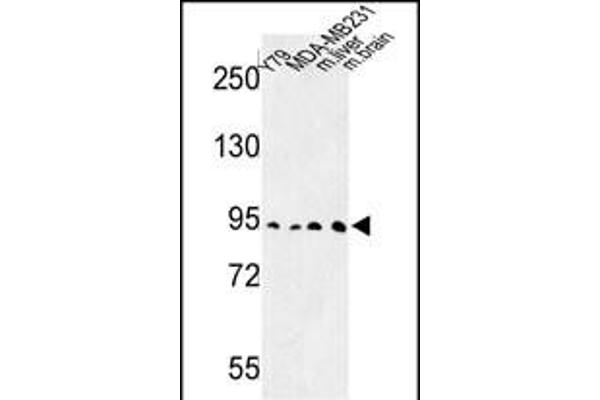 DPP10 antibody  (AA 150-177)