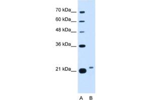 Western Blotting (WB) image for anti-LOC400856 (LOC400856) antibody (ABIN2462913) (LOC400856 Antikörper)