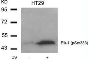 Image no. 1 for anti-ELK1, Member of ETS Oncogene Family (ELK1) (pSer383) antibody (ABIN196615) (ELK1 Antikörper  (pSer383))