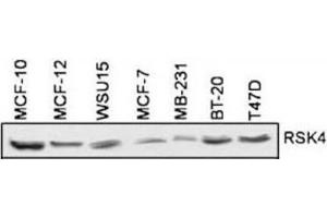 Western Blotting (WB) image for anti-Ribosomal Protein S6 Kinase, 90kDa, Polypeptide 6 (RPS6KA6) antibody (ABIN5023859) (RPS6KA6 Antikörper)