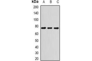 Western blot analysis of ATR expression in H460 (A), Hela (B), mouse spleen (C) whole cell lysates. (ATR Antikörper)