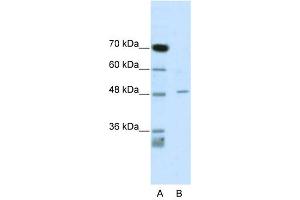 CACNB4 antibody used at 1 ug/ml to detect target protein. (CACNB4 Antikörper  (C-Term))