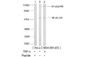 Image no. 2 for anti-Nuclear Factor of kappa Light Polypeptide Gene Enhancer in B-Cells 2 (NFKB2) (AA 868-872) antibody (ABIN197120) (NFKB2 Antikörper  (AA 868-872))