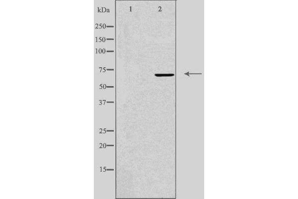 IQCB1 Antikörper  (Internal Region)