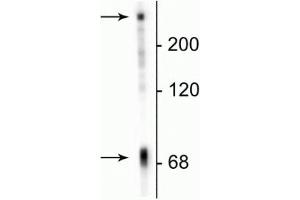 Western blot of neonatal rat brain lysate showing specific immunolabeling of the ~70 kDa MAP2C/D protein. (MAP2 Antikörper)