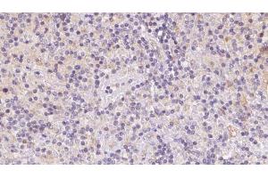 Immunohistochemistry (IHC) image for anti-Vacuolar Protein Sorting-Associated Protein 16 Homolog (VPS16) (Internal Region) antibody (ABIN6265996)