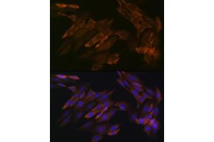 Immunofluorescence analysis of NIH-3T3 cells using DDX6 Rabbit mAb (ABIN7266703) at dilution of 1:100 (40x lens). (DDX6 Antikörper)