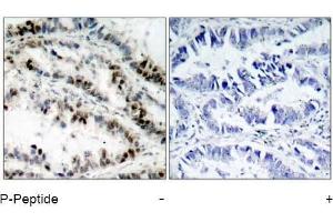Image no. 1 for anti-Structural Maintenance of Chromosomes 1A (SMC1A) (pSer957) antibody (ABIN196936) (SMC1A Antikörper  (pSer957))