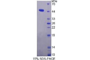 Image no. 1 for Microsomal Triglyceride Transfer Protein (MTTP) (AA 28-459) protein (His tag) (ABIN6236898)