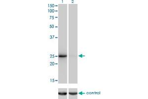 Western blot analysis of THAP1 over-expressed 293 cell line, cotransfected with THAP1 Validated Chimera RNAi (Lane 2) or non-transfected control (Lane 1). (THAP1 Antikörper  (AA 1-213))