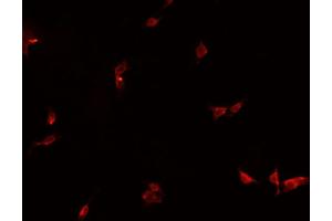ABIN6266867 staining HeLa  cells by IF/ICC. (HEXIM1 Antikörper)