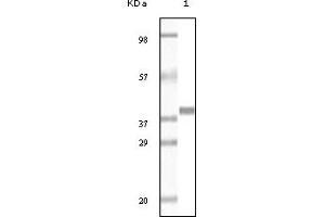 Western Blotting (WB) image for anti-Glutathione S-Transferase pi 1 (GSTP1) (truncated) antibody (ABIN2464062)