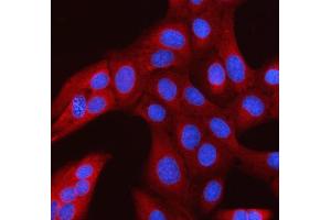 IF analysis of RANBP1 using anti-RANBP1 antibody (ABIN7602058).