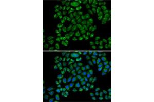 Immunofluorescence analysis of HeLa cells using GRI antibody (ABIN6127964, ABIN6141386, ABIN6141387 and ABIN6218189). (Glutamate Receptor 3 Antikörper  (AA 200-490))