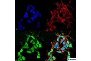 Immunocytochemical staining of SK-N-BE with Scn3b monoclonal antibody, clone S396-29 (Biotin) .