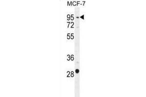 Western Blotting (WB) image for anti-Patched Domain Containing 3 (PTCHD3) antibody (ABIN2996177) (PTCHD3 Antikörper)