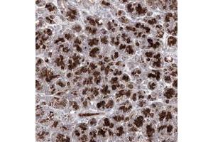Immunohistochemical staining of human pancreas with C11orf80 polyclonal antibody  shows strong granular cytoplasmic positivity in exocrine glandular cells at 1:10-1:20 dilution. (C11ORF80 Antikörper)