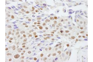 anti-Scaffold Attachment Factor B2 (SAFB2) (AA 175-225) antibody