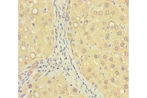 Immunohistochemistry of paraffin-embedded human liver tissue using ABIN7176405 at dilution of 1:100 (ZNF583 Antikörper  (AA 1-300))