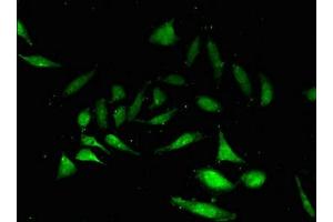 Immunofluorescent analysis of Hela cells using ABIN7161039 at dilution of 1:100 and Alexa Fluor 488-congugated AffiniPure Goat Anti-Rabbit IgG(H+L) (NANOS3 Antikörper  (AA 21-192))