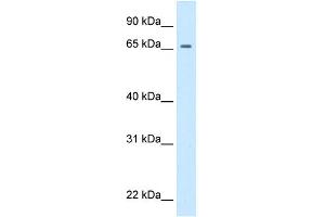 WB Suggested Anti-prd Antibody Titration:  0. (Primary Retinal Dysplasia (PRD) (Middle Region) Antikörper)