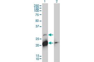 Western Blot analysis of BID expression in transfected 293T cell line by BID monoclonal antibody (M01), clone 3F3-1A3. (BID Antikörper  (AA 1-195))