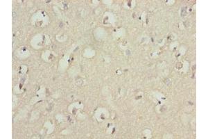 Immunohistochemistry of paraffin-embedded human brain tissue using ABIN7173675 at dilution of 1:100 (TUBB1 Antikörper  (AA 270-451))