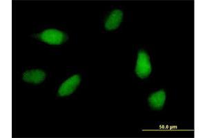 Immunofluorescence of purified MaxPab antibody to SCC-112 on HeLa cell. (PDS5A Antikörper  (AA 1-333))
