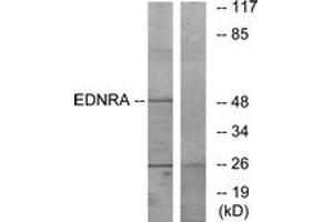 Western blot analysis of extracts from HepG2 cells, using EDNRA Antibody. (Endothelin-1 Receptor Antikörper  (AA 378-427))