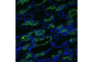 Immunohistochemistry analysis using Rabbit Anti-Aquaporin 3 Polyclonal Antibody .