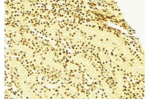 ABIN6276285 at 1/100 staining Mouse liver tissue by IHC-P. (SPHK1 Antikörper  (Internal Region))