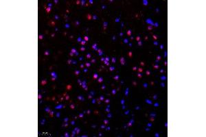 Immunofluorescence of paraffin embedded mouse brain using SR140 (ABIN7076091) at dilution of 1:600 (400x lens) (SR140 Antikörper)