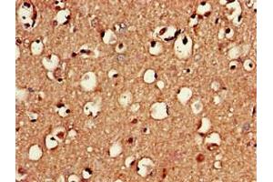 Immunohistochemistry of paraffin-embedded human brain tissue using ABIN7150991 at dilution of 1:100